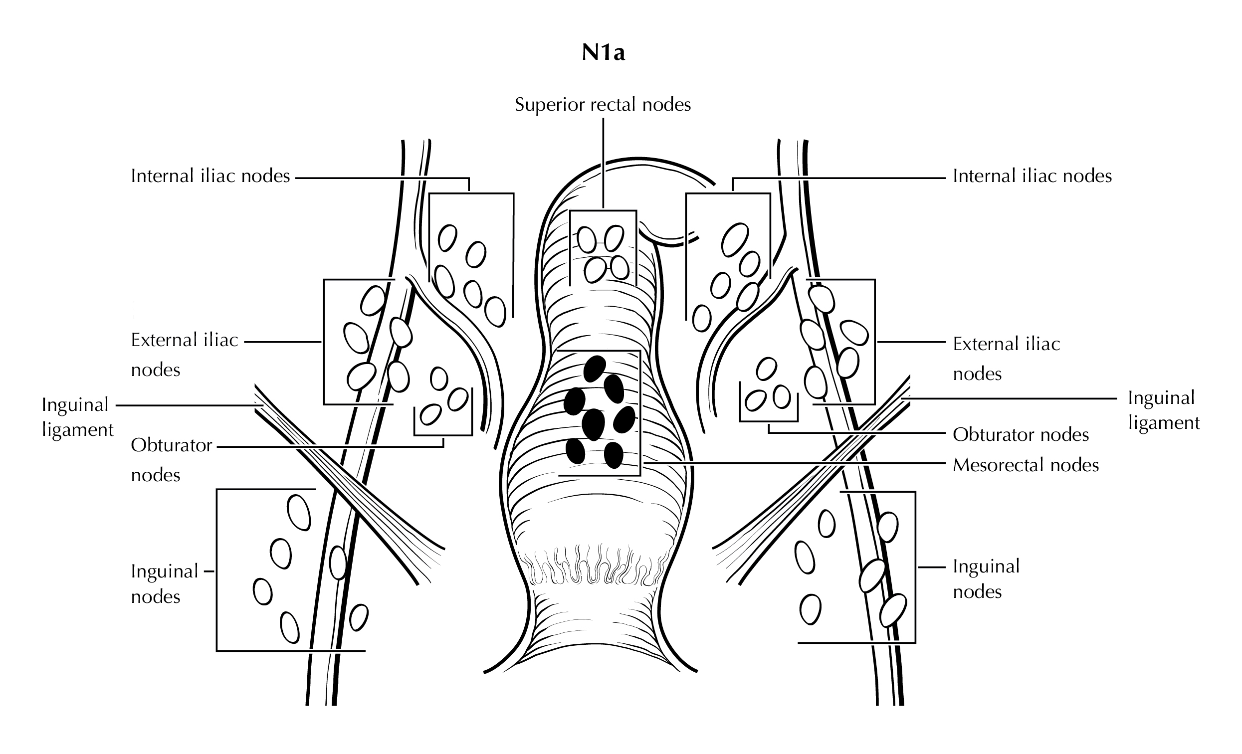 LOWGI_ANUS_N1a.jpg