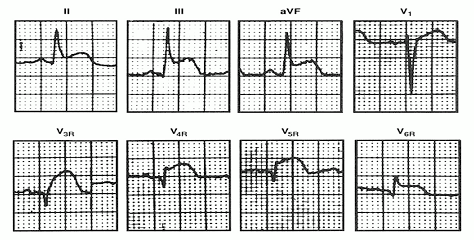 Figure 2.1.gif