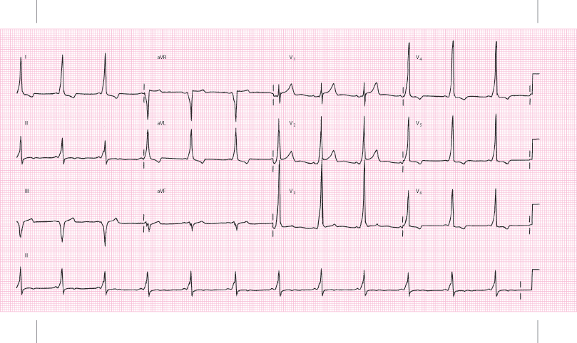 Fig2_3.gif