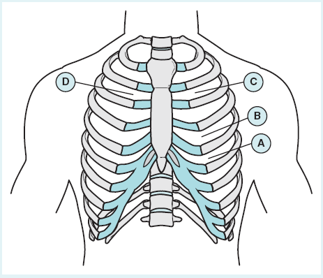 Figure-1.1a
