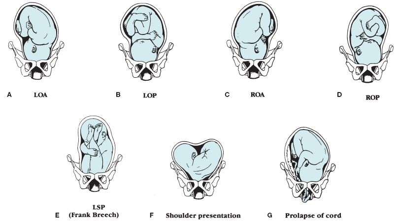 Figure-4.8