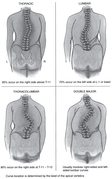 Figure-5.13