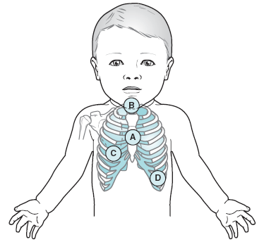 Figure-5.14b