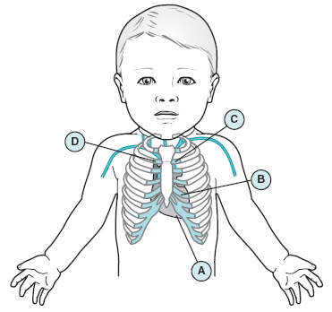 Figure-5.14c