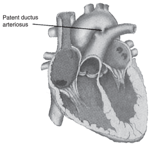 Figure-5.5