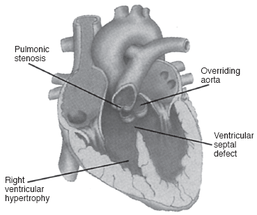 Figure-5.6