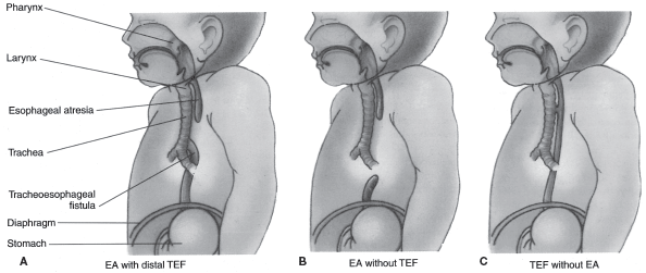 Figure-5.9