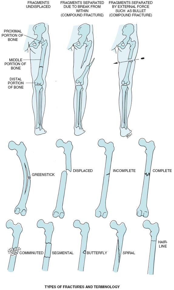 Figure-6.13