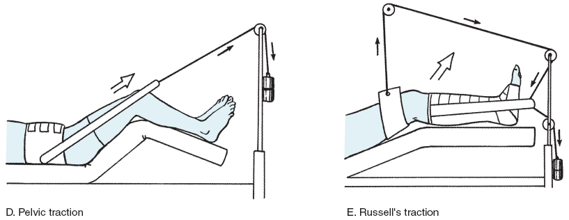 Figure-6.14de