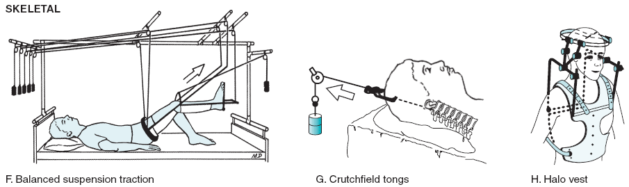 Figure-6.14fgh