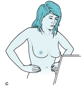 Figure-6.16c