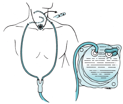 Figure-6.2