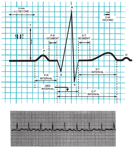 Figure-6.4