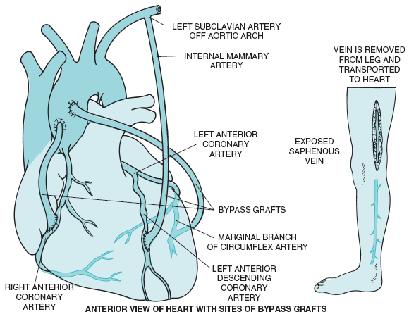 Figure-6.7