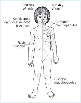 Figure-Table-5.19d