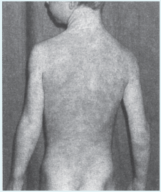 Figure-Table-5.19e